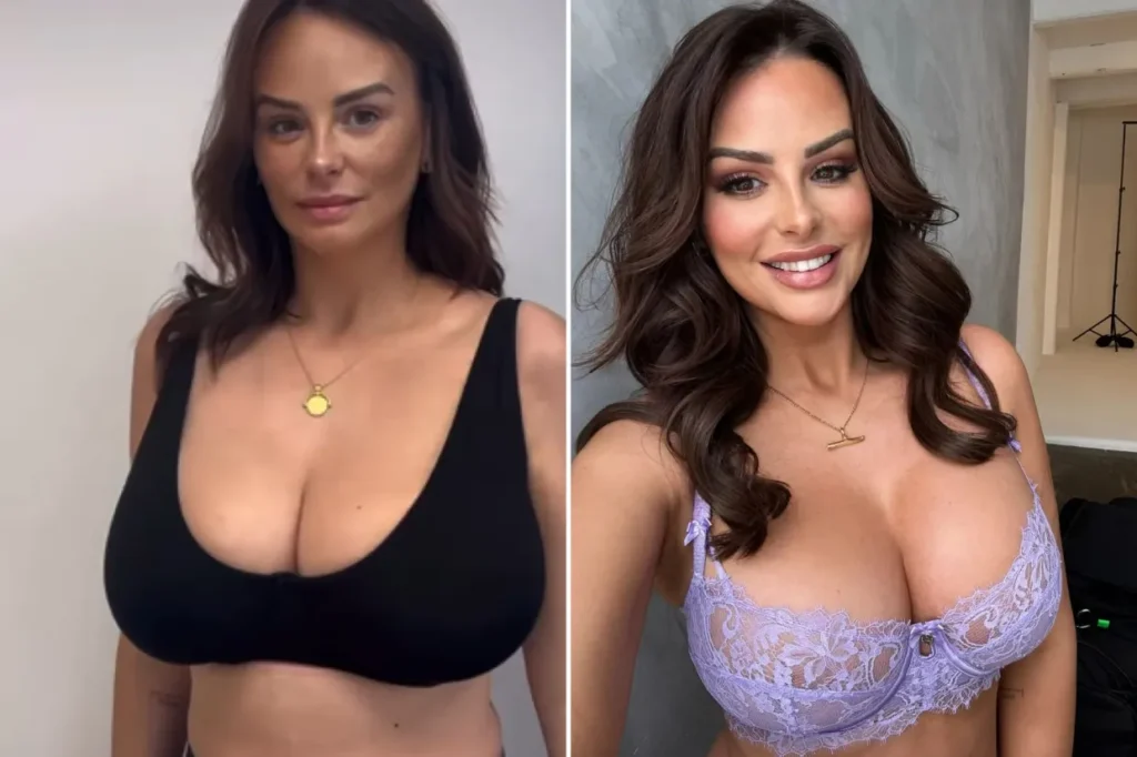 Why More Stars Are Choosing Breast Reductions