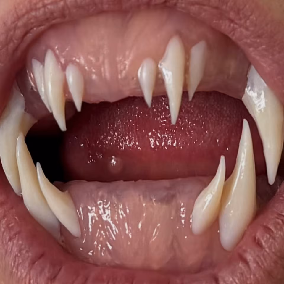 Heidi Klum brings Medusa to life at 2025 Halloween party